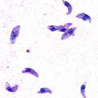 Toxoplasma gondii tachy, from Wikipedia
